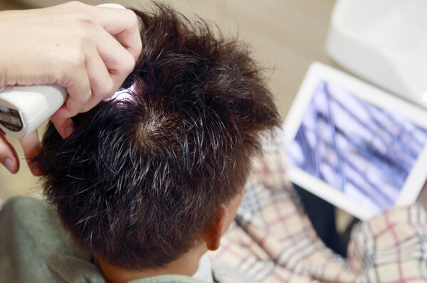 頭皮ケアと美肌のすすめのイメージ写真